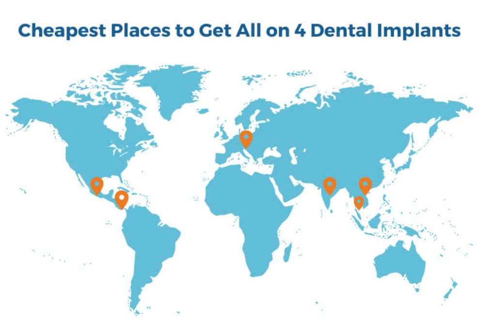 Tooth implants overseas - Budapest, Hungary vs Turkey